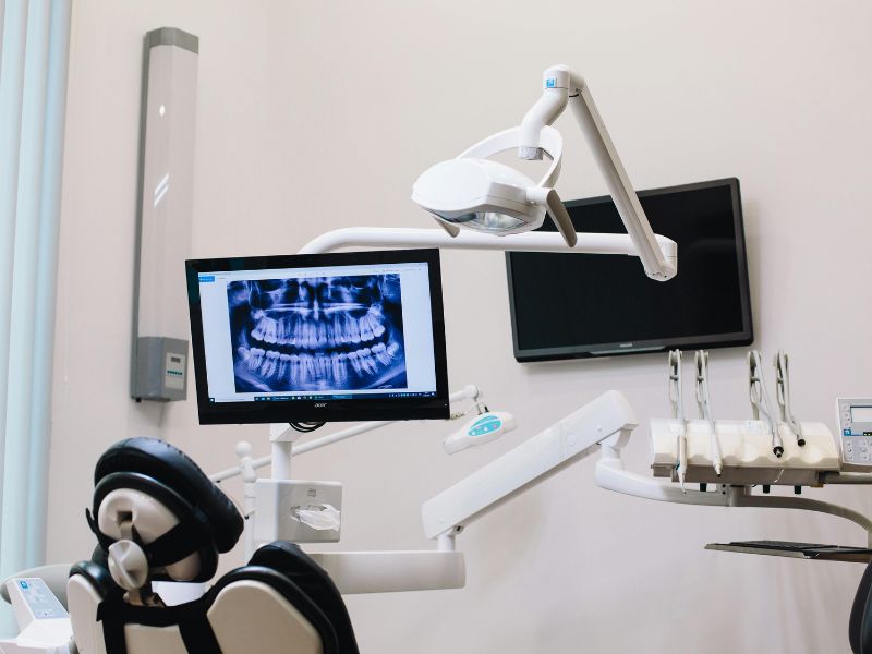 Digital X-Ray System